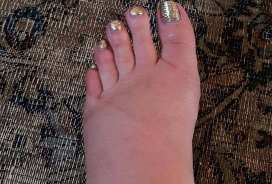 Pregnant Jessica Simpson Reveals Photo Of Her Swollen Feet And Asks For